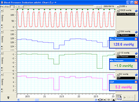 生波形、収縮期圧、拡張期圧、平均血圧をリアルタイムで表示。